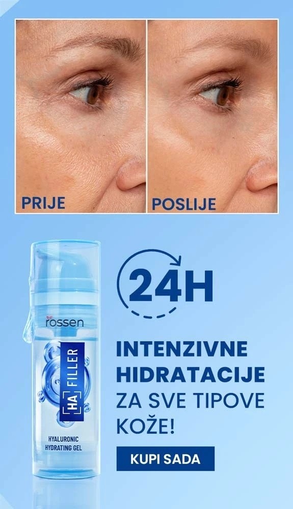 imageA